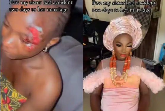 Bride-to-be involved in accident 2 days before wedding