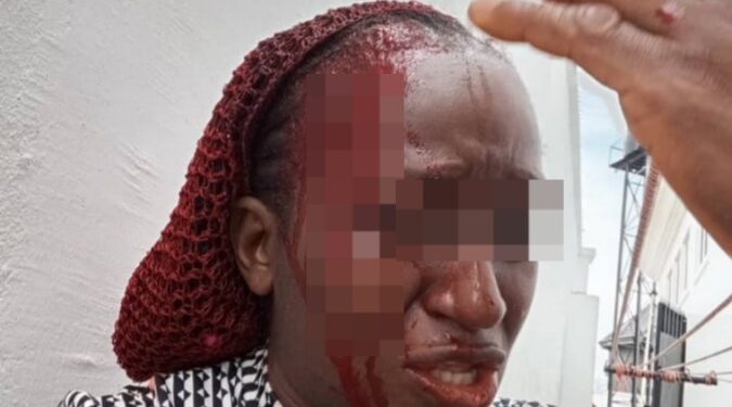Police Begin Probe As Husband Brutalises Wife In Delta