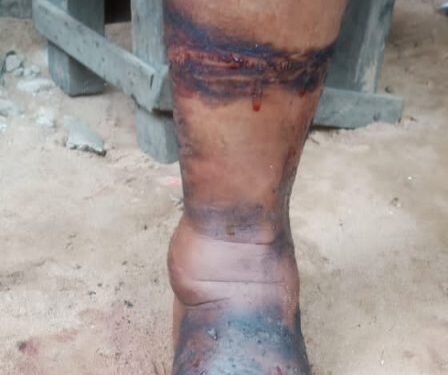 Group Condemns Anambra Agents For Brutalising Nursing Mother (Graphic Photos)