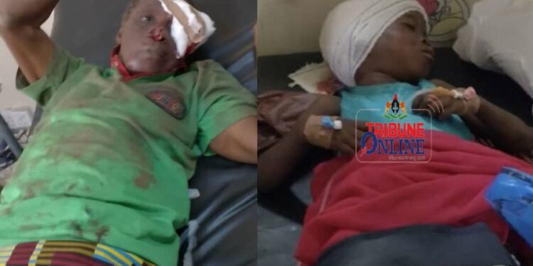 Dog Eats Flesh Off Girl’s Head, Attacks Owner Trying To Protect Victim In Ibadan