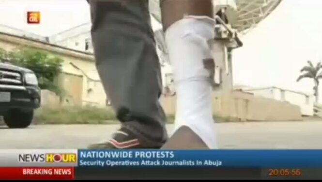 AIT Camera Operative Covering Abuja Protest Breaks Leg While Fleeing From Police