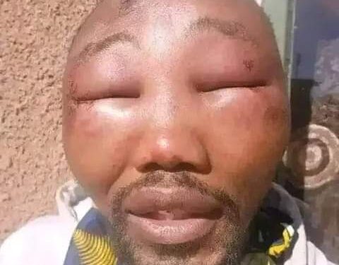 Kebbi APC ward chairman allegedly beaten for preaching Tinubu’s achievements