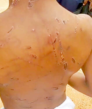 Police Arrest Couple For Allegdly Assaulting Their 8-Year-Old Maid In Edo