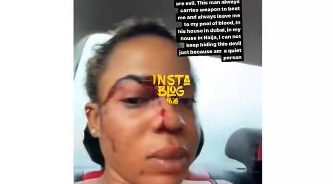 Dubai-Based Influencer, Kenny Kehinde, Accused Of Domestic Violence (Photos)