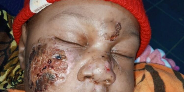 Father Demands Justice After His Baby Was Attacked On The First Day At Daycare