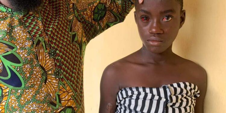 Imo State Woman Sets Step Daughter On Fire For Eating Food (Video)