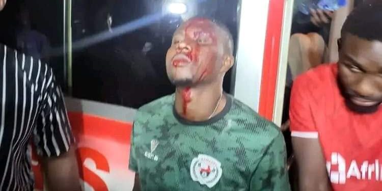 Enugu Rangers Coaches And Players Attacked, Beaten By Plateau United Fans (Photos)