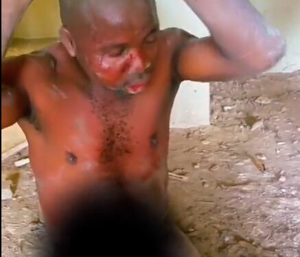 Smugglers Beat & Injure Customs Whistleblowers (Disturbing Photos)