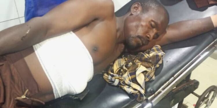 Herbalist Accidentally Shoots Himself While Testing ‘Bulletproof’ Charm