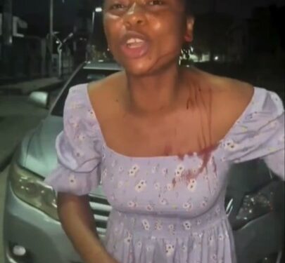 Lady In Tears After Police Beat Her Up In Port Harcourt (Video)
