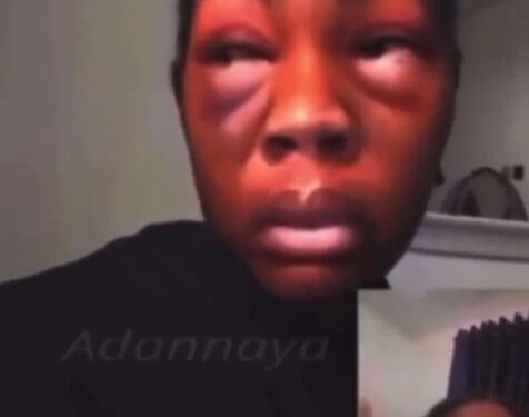 ‘My Boyfriend Mistakenly Over-Beat Me For Checking His Phone’ – Lady (Video)