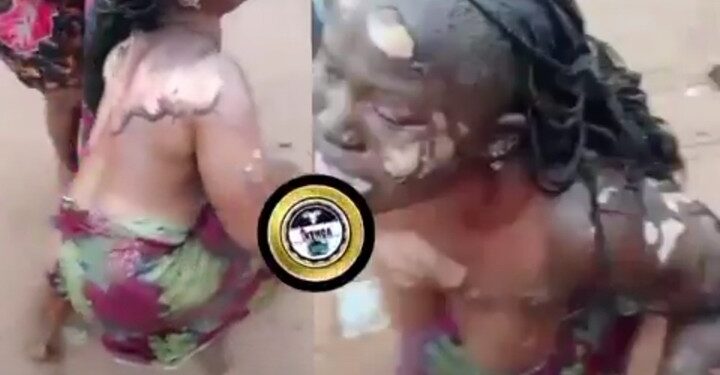 Husband Sets Wife Ablaze In Anambra Over Suspicion Of Infidelity