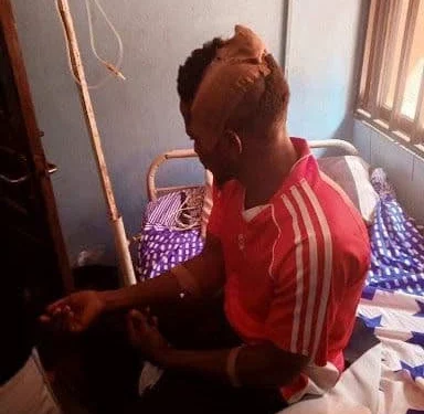 Female Tenant Breaks Landlord’s Head With Pestle After Receiving Quit Notice (Photos)