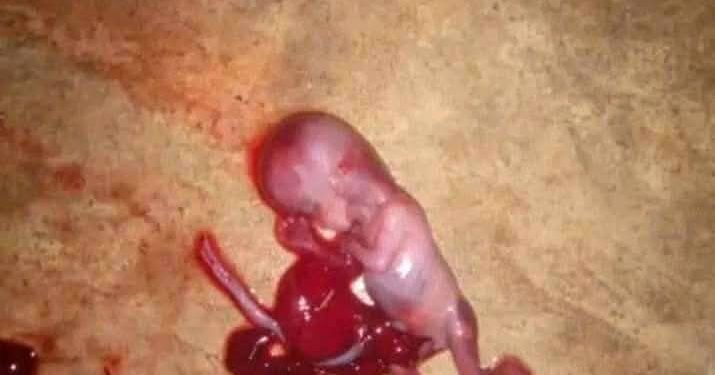 Fetus Found Dumped In Port Harcourt, Rivers (Graphic Photo)
