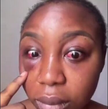 Driver Beats A Lady Over AC Argument (Photos, Video)