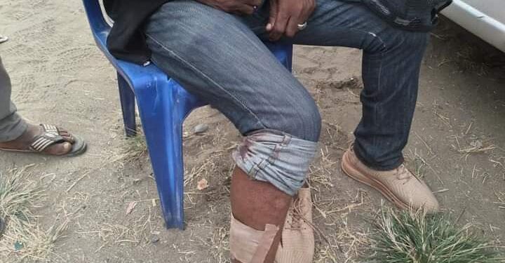 Explosion Rocks Port Harcourt APC Rally, Three Injured (Photos)