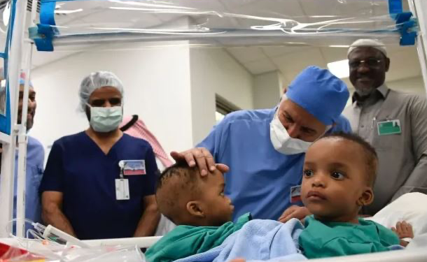 Conjoined Nigerian Twins Separated In Saudi Arabia