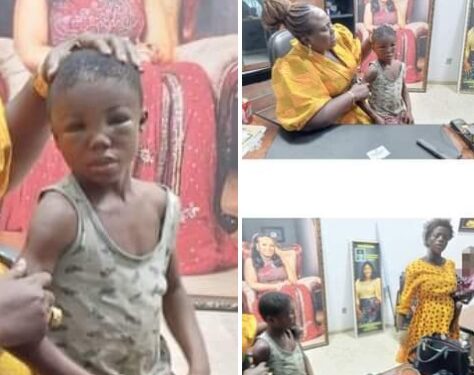 Pregnant Woman Brutalizes Her 7-year-old Nephew in Anambra For Eating Fish And Failing To Recite English Alphabet (Photos)