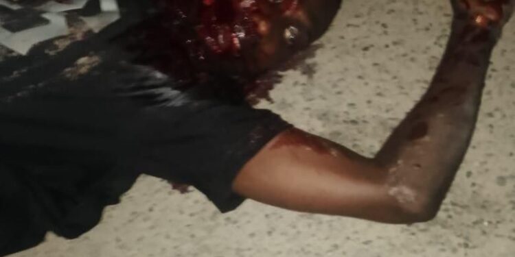 Gunmen Murder Students Leader, Endwell Ejindu, In Rivers State (Disturbing Photos)