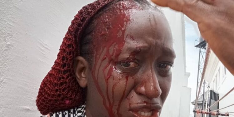 Man calls out his sister’s husband for ‘abusing’ her all through their 15-year marriage as he shares injury he allegedly inflicted on her head with pestle