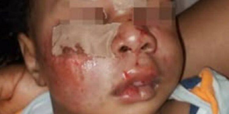 Parents of baby mauled by dog at Lagos school accuses proprietress of intimidation and obstruction of justice (video)