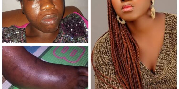 He can go from midnight till morning even when I was in serious pain due to ankle sprain – Nigerian woman shares her experience of ‘sexual abuse’ in marriage