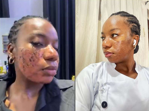 Lady permanent scar she got from aesthetic clinic following skin treatment