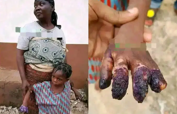 Grandmother arrested for burning granddaughter’s hands after she ate Indomie