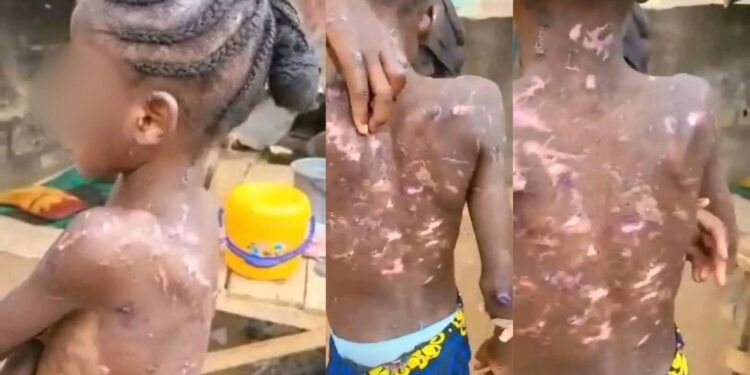 Abuja CP orders arrest of woman accused of abusing and burning her maid (video)