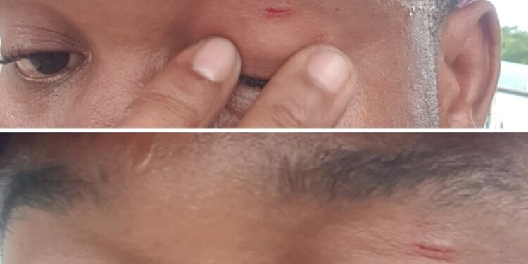 Effeminate male chef shares encounter with Lagos louts who attacked him for “walking like a woman”