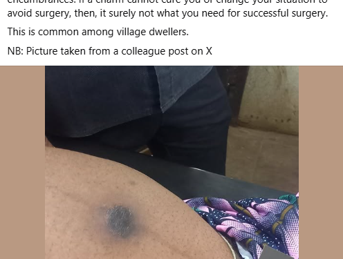 When coming to theatre for surgery, kindly remove your charms – Nigerian doctor says