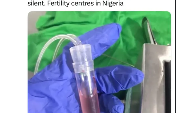 “Girls are now selling their eggs to survive” — Doctor raises alarm over growing trend in Nigerian universities