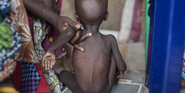“420,000 Nigerian children could di£ this year due to severe acute malnutrition” UNICEF warns