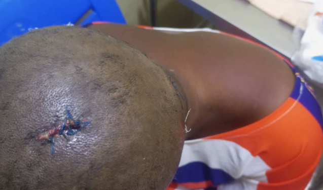 Ghanaian man attacks his fiancée with hammer over cheating allegations