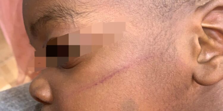 Woman shows what husband did to their 2-year-old son after she left him in his care (photos)