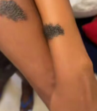 Man shocked to discover his friend and girlfriend have same birthmark