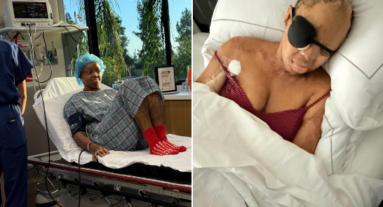 Sosoliso plane crash survivor Kechi Okwuchi undergoes eyelid surgery