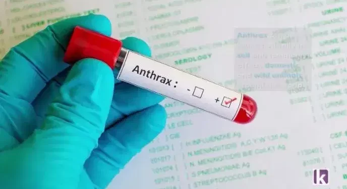 FG alerts Nigerians over outbreak of anthrax in Zamfara