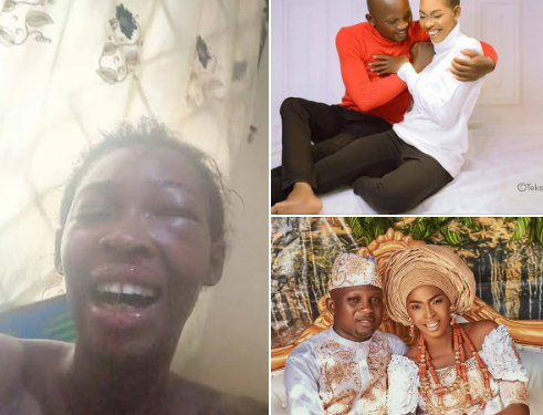 I don’t regret marrying my lovely husband – Nigerian woman brutalised by her husband defends him (video)