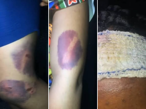 Nigerian lawyer rescues 23-year-old woman allegedly brutalised by her boyfriend