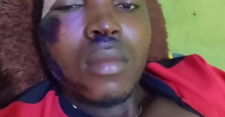 How Anambra Journalist Survived Armed Men Attack (Photos)