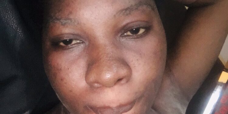 ‘How My Edo Poly Lecturer Boyfriend Left Me With Twin Pregnancy To Japa’ – Lady Speaks