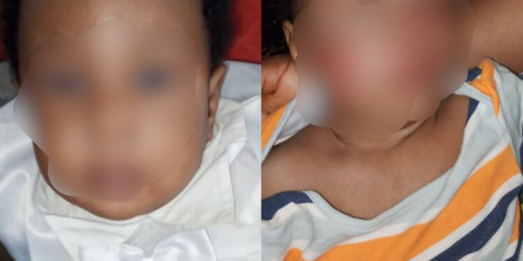 Father demands justice after his baby was attacked on the first day resuming at a day care (graphic photos)