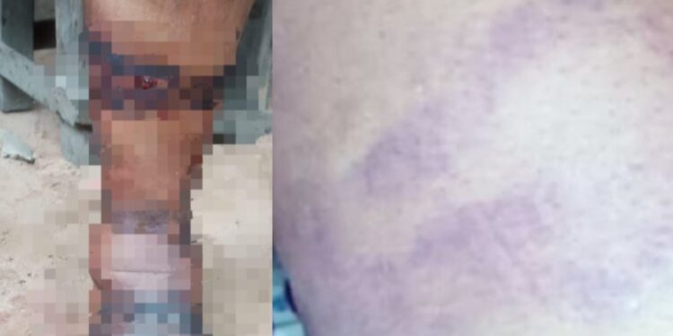 Nursing mother allegedly brutalised by Special Anti Touting squad in Anambra