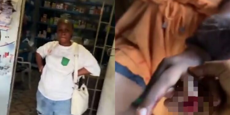 Woman bites off another woman’s finger “because of a man” (video)