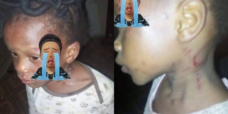 Mother allegedly beat her 2-year old brutally for not knowing how to count 1-200 in Ondo state (photos)