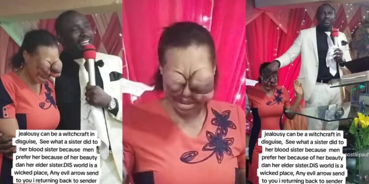 Lady allegedly damages sister’s eye out of jealousy over beauty preference from men