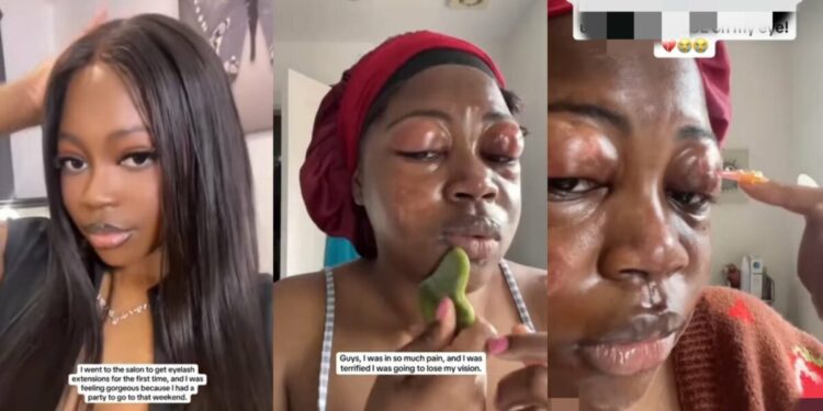 Lady shares how her eyelids began to swell after using eyelash extensions