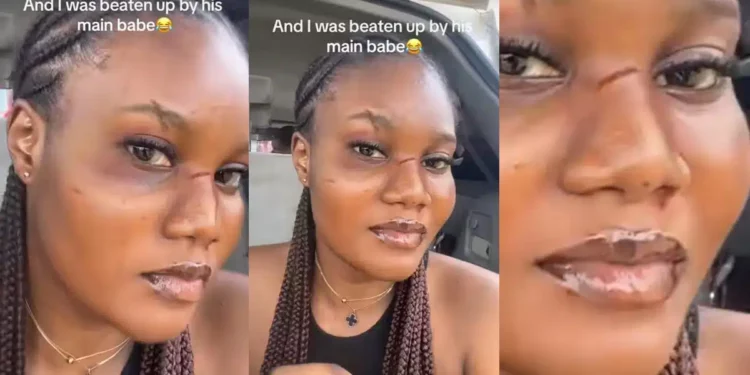 Nigerian lady gets her face redesigned by boyfriend’s main girlfriend after unannounced visit to his house