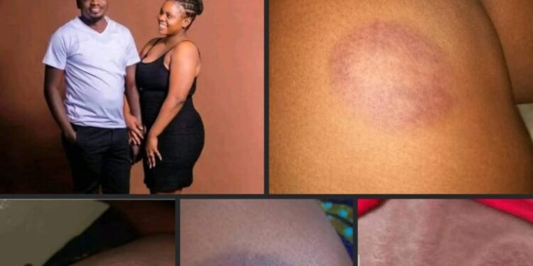 Lady cancels wedding over fiancé’s physical abuse, fears for her life